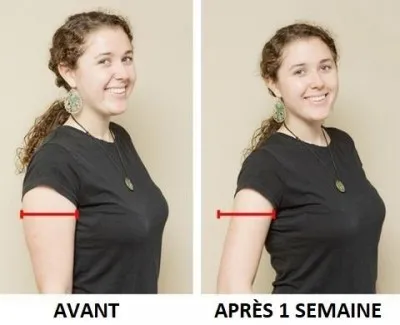 Manchons De Compression Pour Les Bras (lot de 2) Manchons De Compression Pour Les Bras (lot de 2)